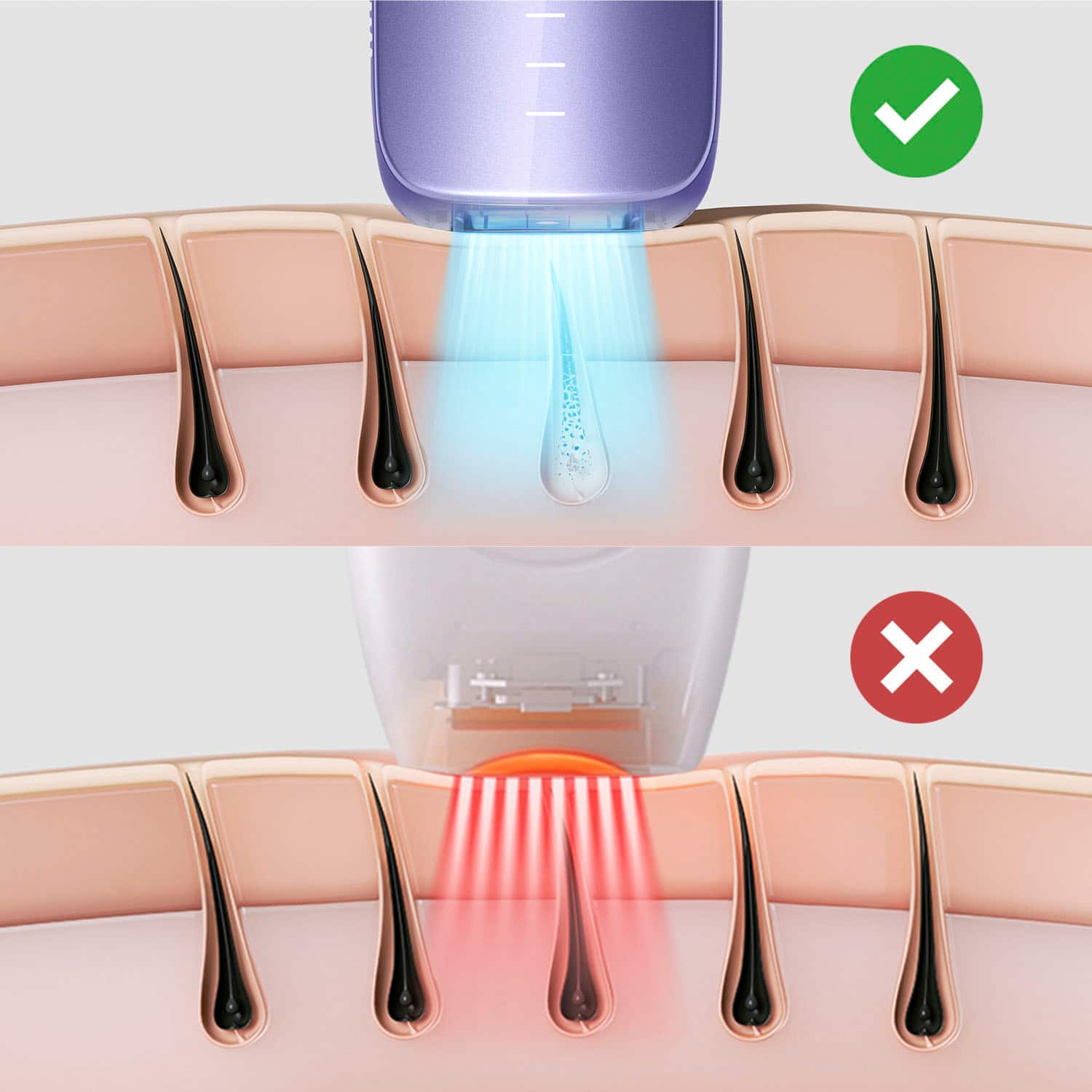 Ulike - Dispositivo de remoção de pêlos IPL com resfriamento de gelo Air 3 - Roxo-UI06 PR