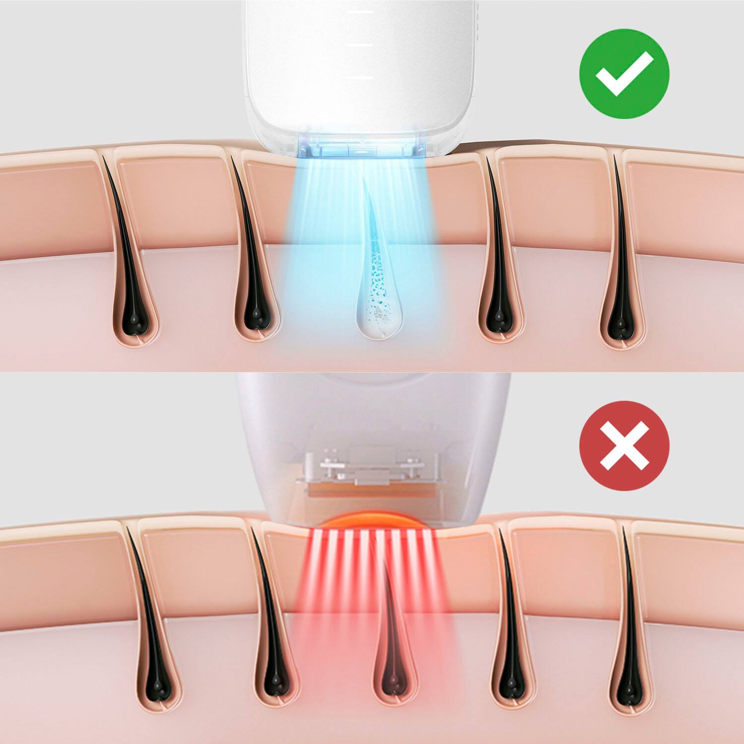Ulike - Dispositivo de remoção de pêlos IPL com resfriamento de gelo Air 3 - Branco-UI06 WH